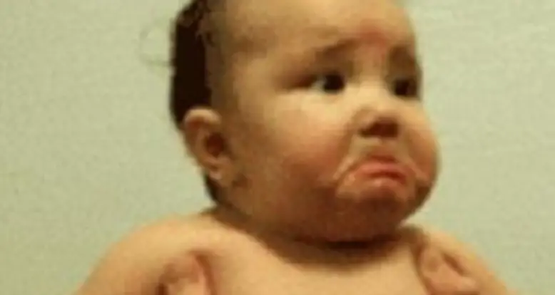 A Frowny Faced Baby